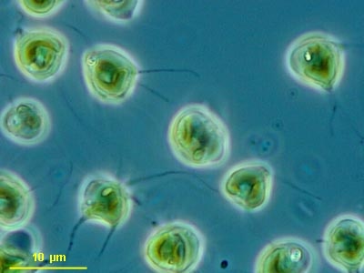 CCMP1857 | NCMA at Bigelow Laboratory
